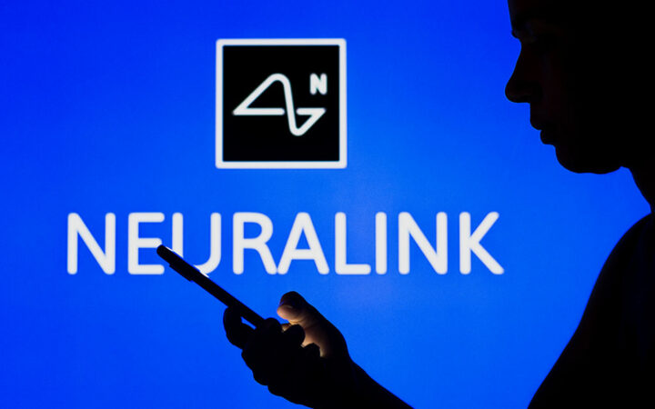 Elon Musk’s Brain-Implant Company Neuralink Raises $280M in New Funding Round