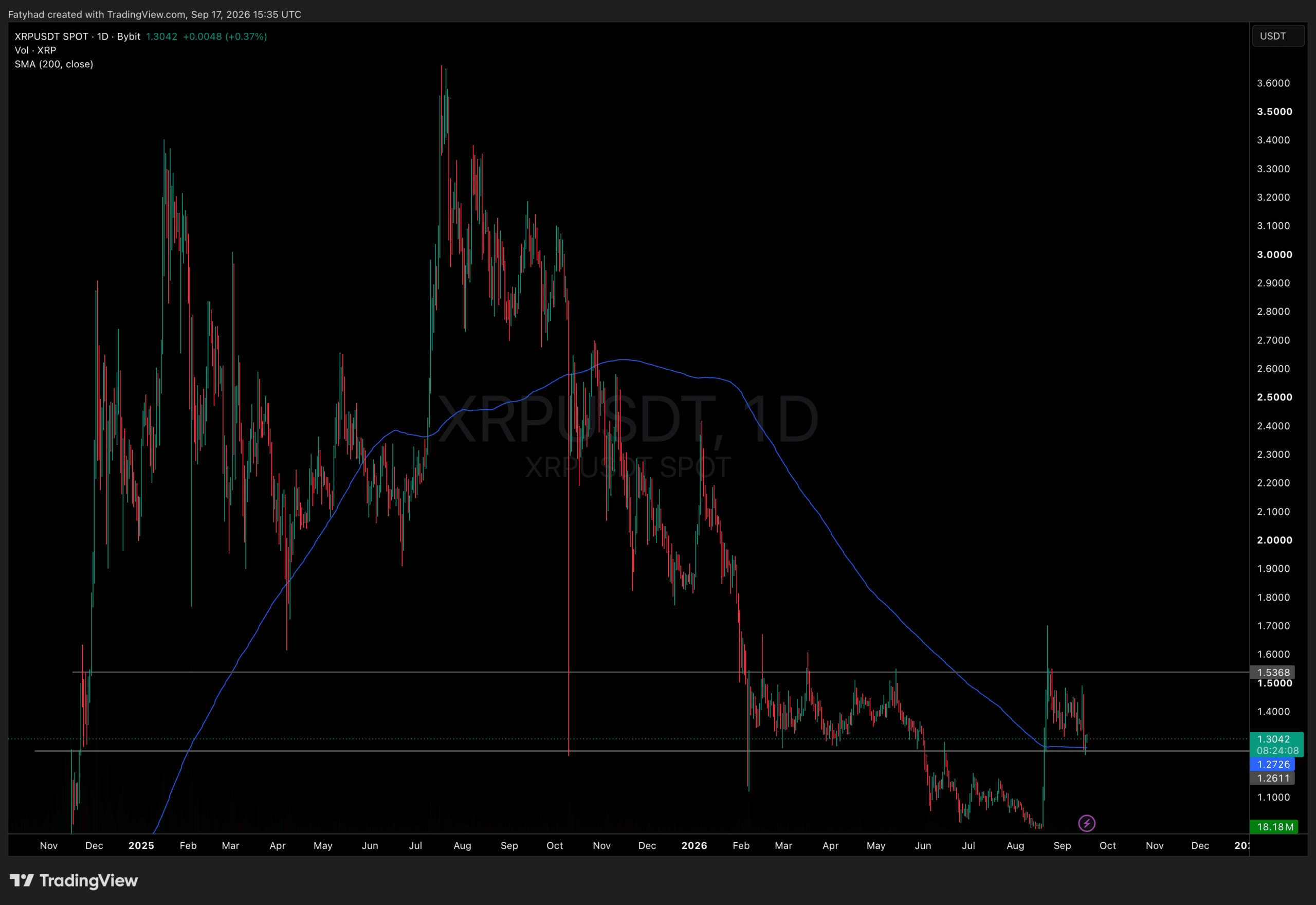 XRP Price Forecast: 75% Holders Bought Above $2, Should You Sell?
